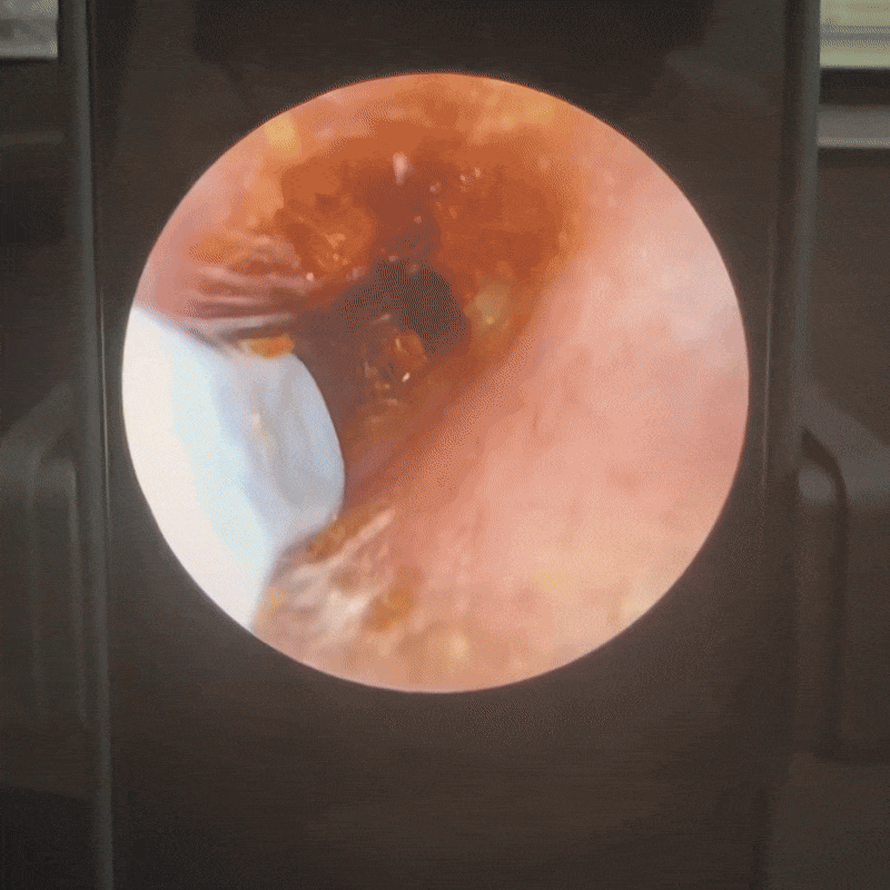 Autior EarVisor : Doctor Approved Ear Health Technology