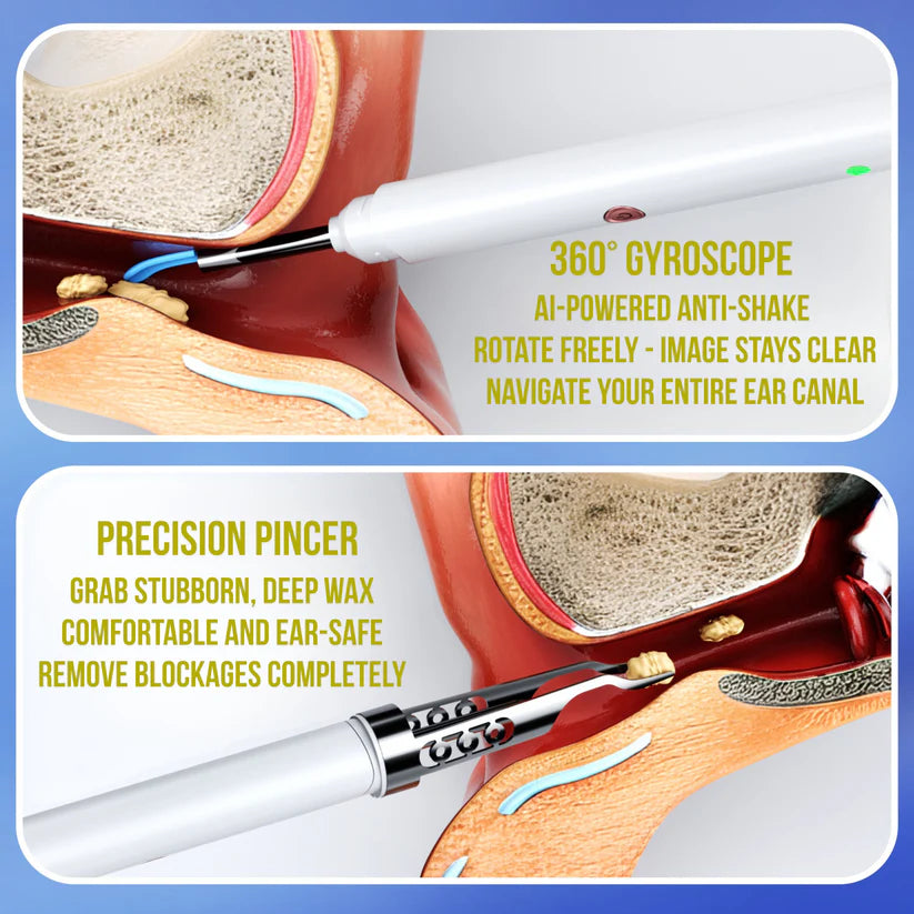 Autior EarVisor : Doctor Approved Ear Health Technology